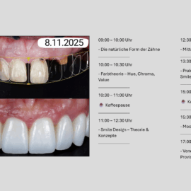STUDENTENKURS | Smile Design & Veneers